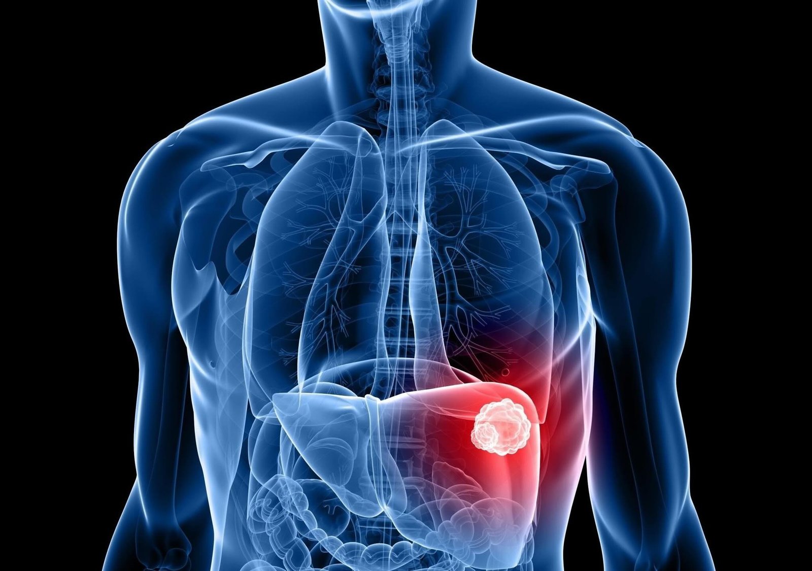 Hepatobiliary Surgery